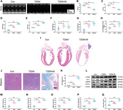 FSTL1-USP10-Notch1 Signaling Axis Protects Against Cardiac Dysfunction Through Inhibition of Myocardial Fibrosis in Diabetic Mice